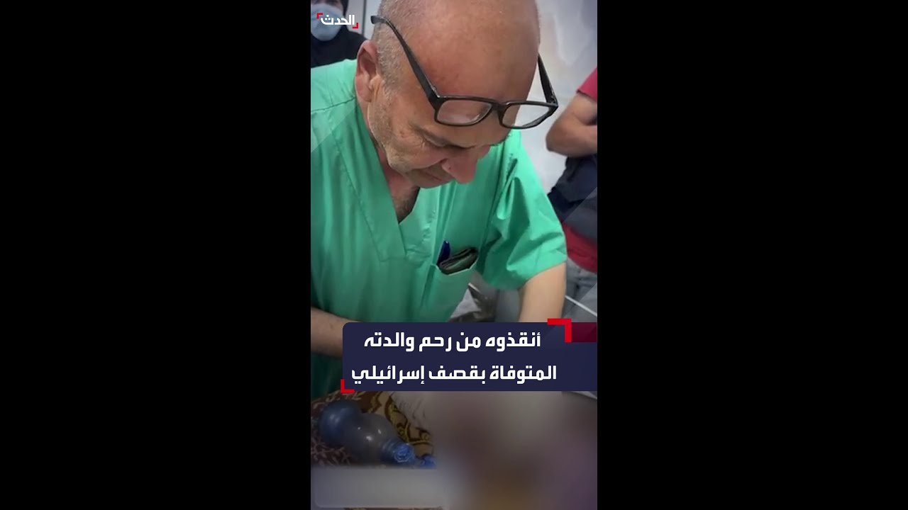 طبيب فلسطيني في المستشفى الكويتي بغزة ينقذ جنينا من رحم والدته بعد أن توفيت