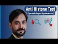 Anti Histone Test | Drug Induced Lupus | DILE | MLT Hub with kamran