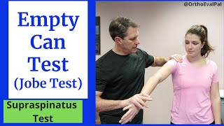 Empty Can Test/Jobe Test (Supraspinatus Special Test)