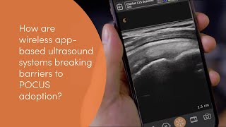 Handheld POCUS: Dropping Barriers to Better Patient Care