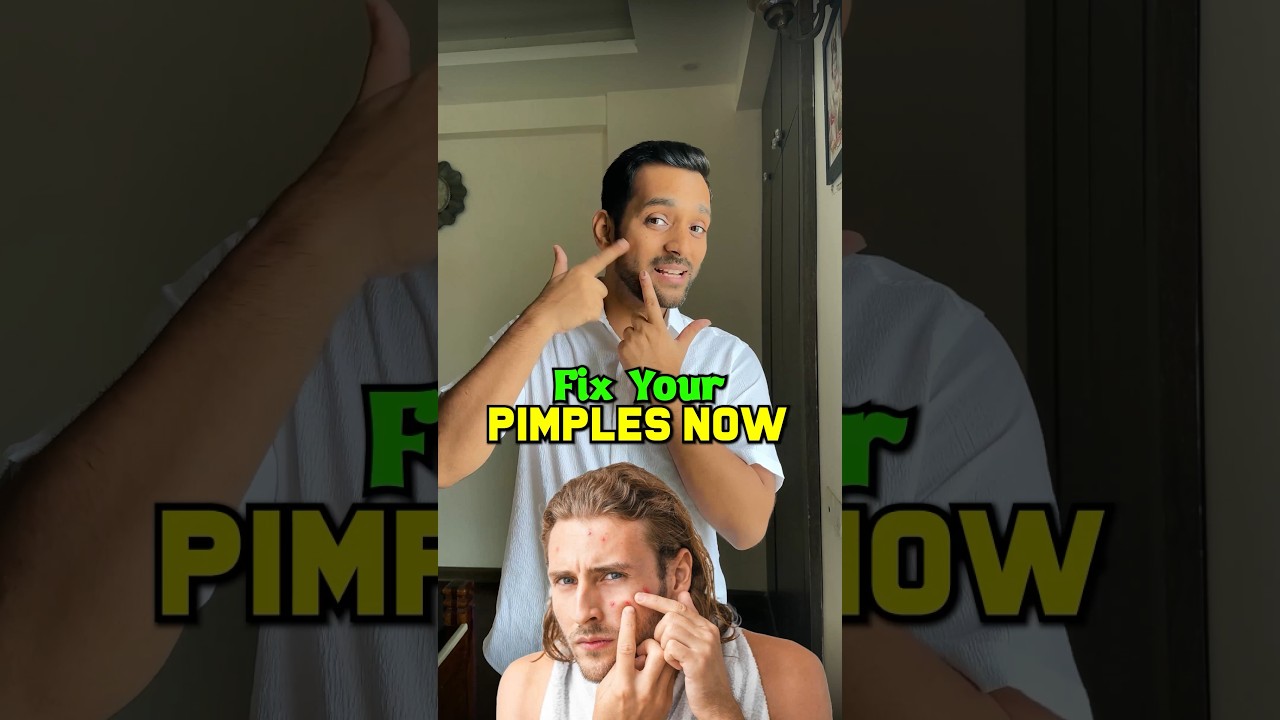 Fix Acne Pimples Now ✅ | Acne Marks and Teenage Pimple Problem #acnecure  #skincare #ashortaday