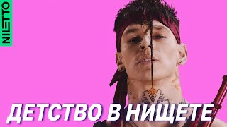 NILETTO рассказал о травле и нищете в детстве