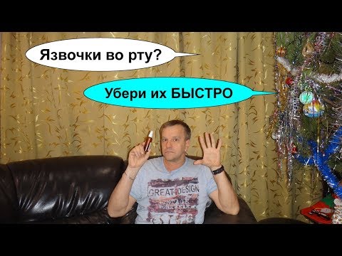 Как лечить стоматит во рту у взрослого в домашних условиях