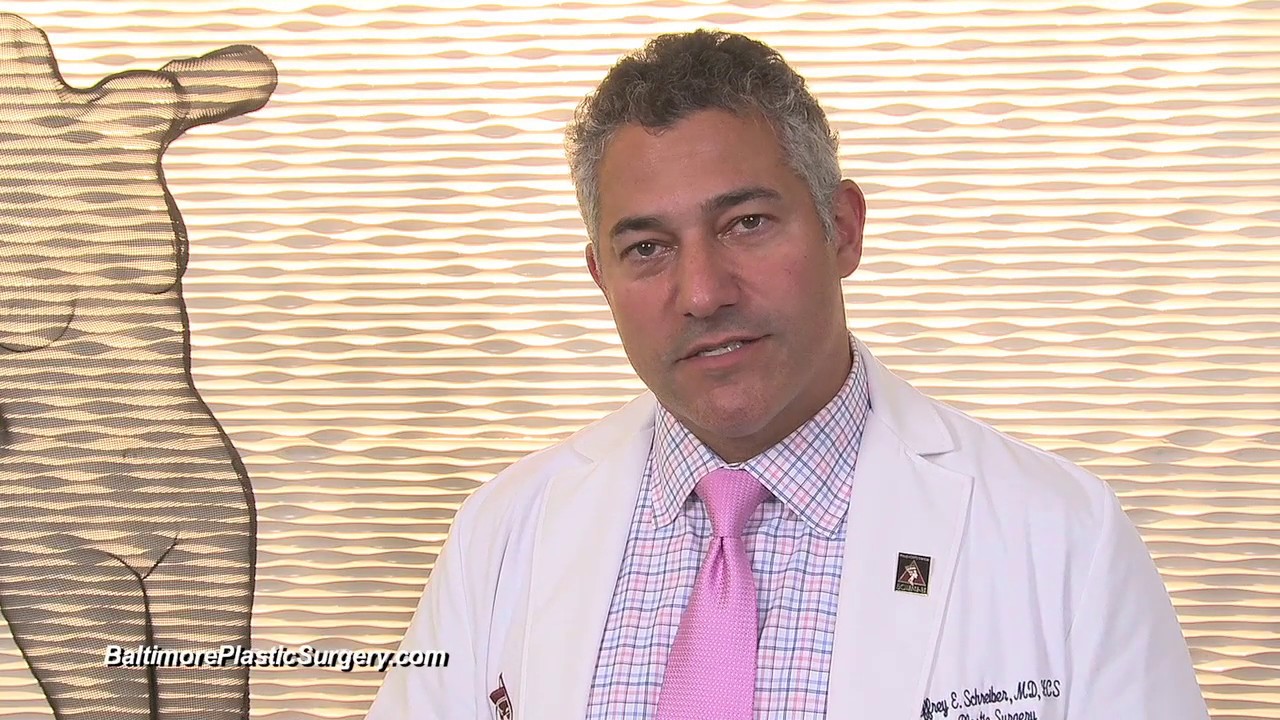 Baltimore Arm Lift (Brachioplasty) Video by Plastic Surgery Expert, Dr