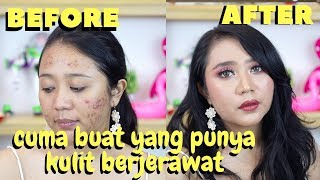 TUTORIAL MAKEUP UNTUK KULIT BERJERAWAT (TIPS SUPAYA MAKEUP TAHAN LAMA DAN TIDAK CAKEY)