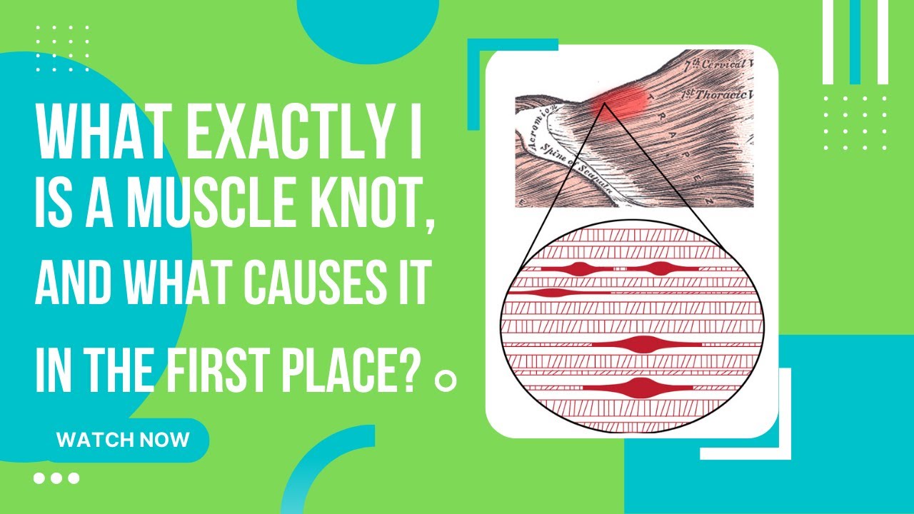 What are muscle knot? How to relieve a muscle knot? YouTube