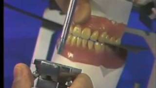 Delivery of Complete Denture  Part 2