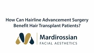 How Can Hairline Advancement Surgery Benefit Hair Transplant Patients?
