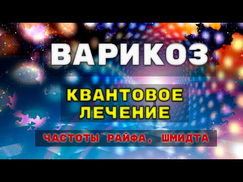 Видео: Неинвазивное лечение варикозного расширения вен