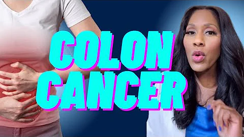 COLON CANCER: What Are Risk Factors? How to Lower Your Risk! A Doctor Explains