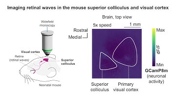 Imaging retinal waves in the mouse superior colliculus and visual cortex