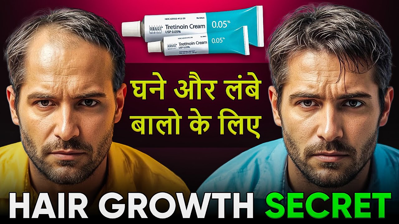 Tretinoin Cream on Hair - Hair Surgeon Reveals the Truth | Tretinoin Before and After #hairstyle