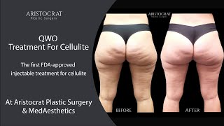 Meet QWO - the new FDA-approved treatment for cellulite