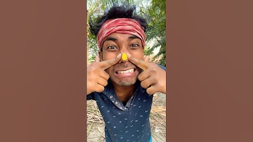 How I Cured a Bug Bite with Yogurt in the Wild | Survival Hacks 🤣🤣🤯#asmr #foryou #shorts