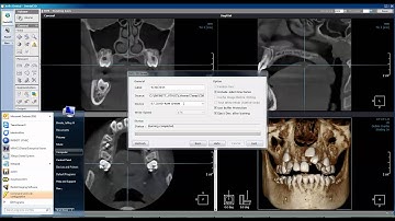 How to Burn DVD LED Dental Xelis 3D Viewer