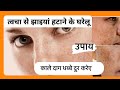 पुराने से पुराने काले दाग धब्बों को10 दिनों मैं ठीक करें…