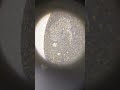 Amazing Paramecium Under Microscope 🔬