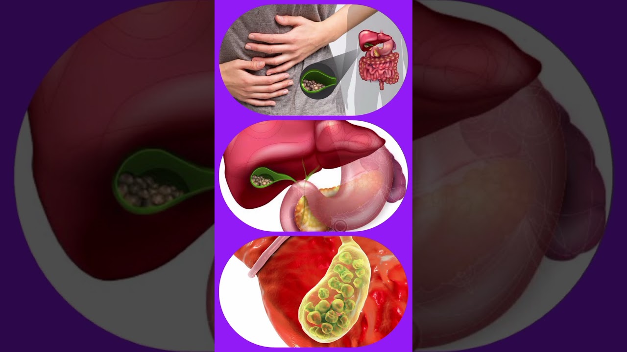 Carduus Marianus Q Homeopathic Medicine 