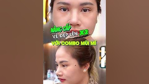 Sau combo nâng mũi & cắt mí, khách hàng thành công nâng cấp tối đa nhan sắc