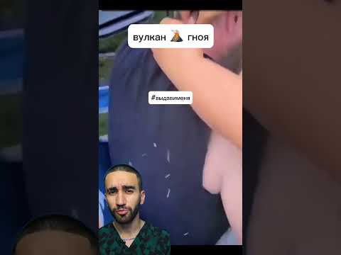 гнойный вулкан Килиманджаро
