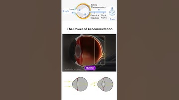 How lenses are used in our eyes #foryou #reflection #shorts