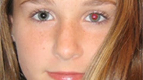 Remove Red Eye in Photoshop |