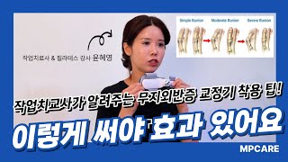 무지외반증 교정기 | 작업치료사가 알려주는 사용 팁