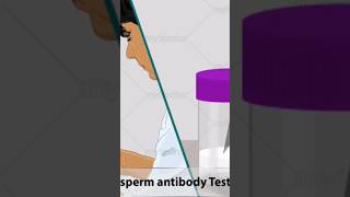 How Antisperm Antibodies Are Formed How It Cause Infertility