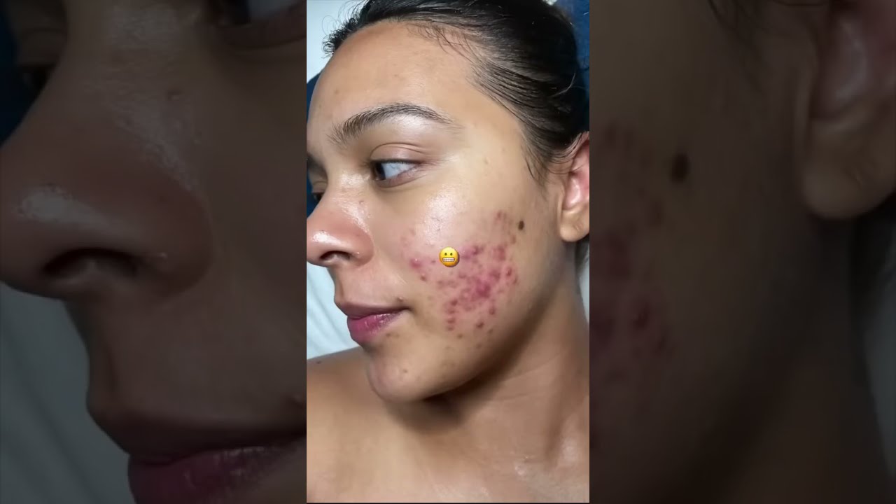 Skincare Gone Wrong Tips #esthetician #reactionvideo #skincaretips #skincare #viral #reaction