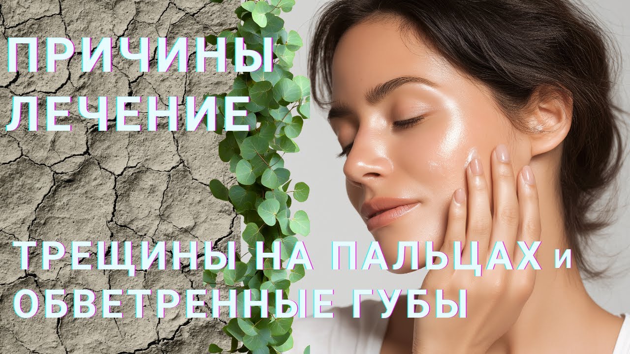 Трещины на пальцах. Обветренные губы. Причины. Лечение. Что делать? Сухая кожа #сухаякожа