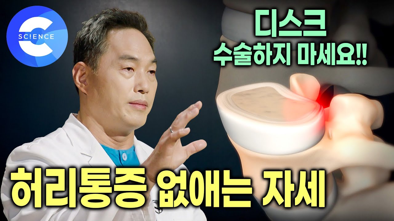 자세 교정으로 좋아지는 허리통증 | 디스크 손상시키는 원인 3가지 | 정선근 교수의 수술없이 허리통증 치료하는 법 | 명의