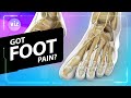 The cause of your foot pain (3D Animation)