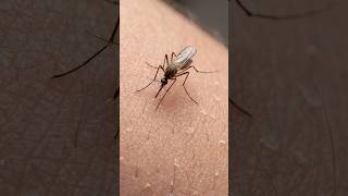 Why you should NEVER scratch a mosquito bite! #shorts