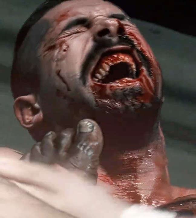 Pain Made Him Stronger🥺