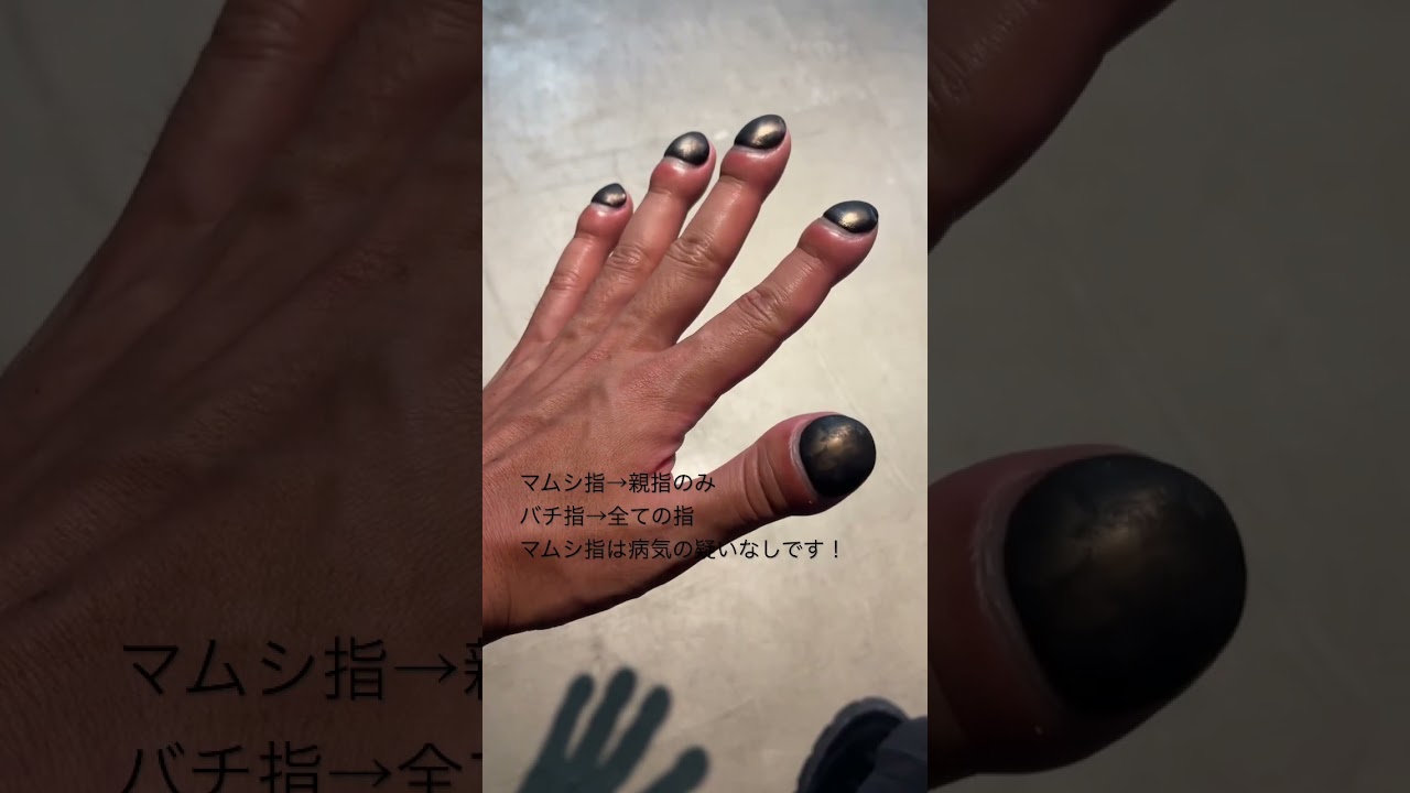 マムシ指に対し これはバチ指ですか とよく聞かれるのですが よく見ると結構違います バチ指 Youtube