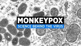 Everything you need to know about monkeypox