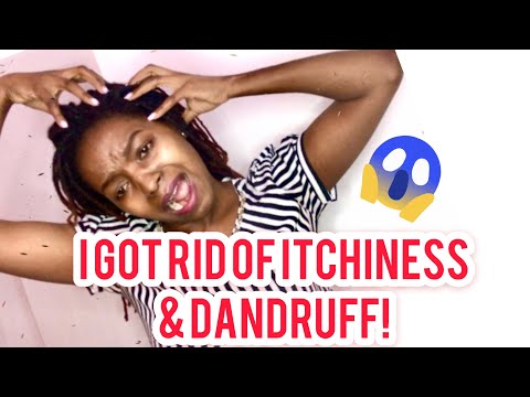 how-to-clean-a-dry,-itchy,dandruff-scalp||dreadlocs/braids||part-2