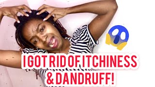 HOW TO CLEAN A DRY, ITCHY,DANDRUFF SCALP||DREADLOCS/BRAIDS||PART 2