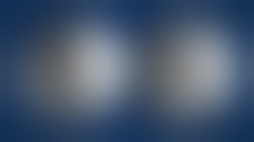 Medial Opening Wedge Proximal Tibial Osteotomy