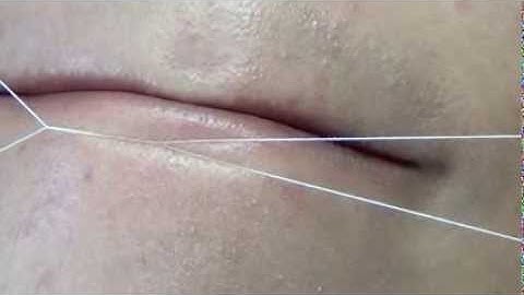 Facial and Eyebrow Threading Tutorial With Use of the Helix ThreadEase