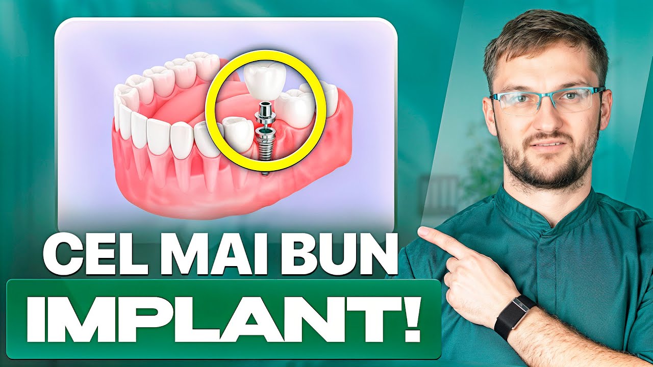 Cele mai bune implanturi dentare în 2026! / Diferența dintre implanturile dentare...