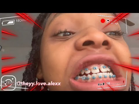 come with me to get my braces tightened and my color change vlog