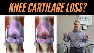 Knee Cartilage Loss: How To Help Knee Cartilage Without Surgery