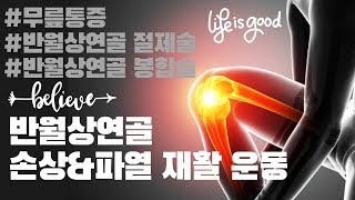 (무릎통증)반월상연골 손상&amp;파열 재활운동(semicircular cartilage rehabilitation)