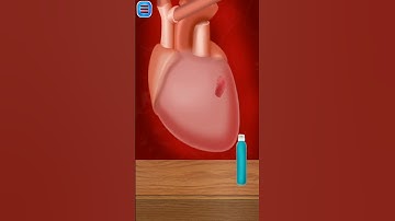 Heart Bypass Surgery ASMR Animation/ASMR |Heart Surgery Animation| Open Heart Surgery Animation #yt