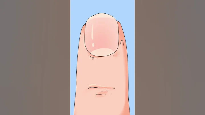 手上的倒刺你是怎麼處理的？Have barbs on your hands? - 天天要聞