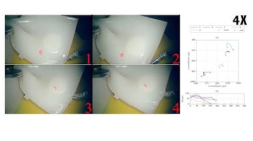 IEEE RAL 2018- Manipulation of Unknown Deformable Tissues Using Continuum Manipulators
