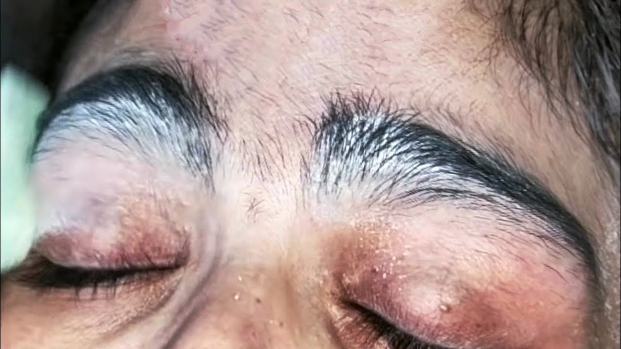 Heavy growth hair eyebrows.