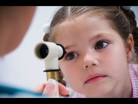 Video: Come Diagnosticare l'Occhio Rosa: 12 Passaggi (con Immagini)