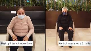 Parkinson Hastası Fidan Hanımın Beyin Pili Ile Değişimi Doç. Dr. Ali Zirh
